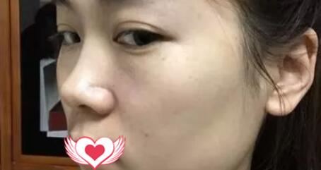 王宝林