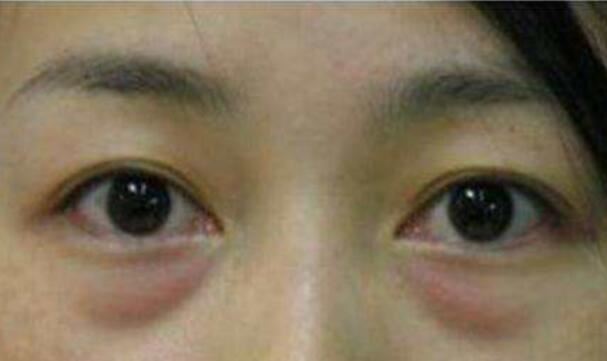 王洁