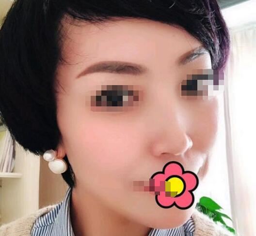 周展超