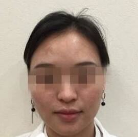 张哲