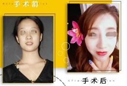 邓文举