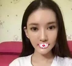 张静