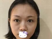 张静