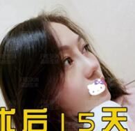 张静