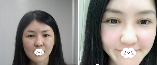 黄艺