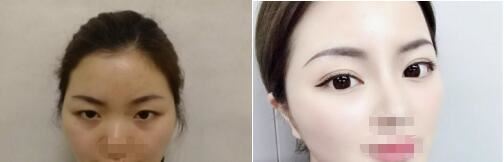 张庆国