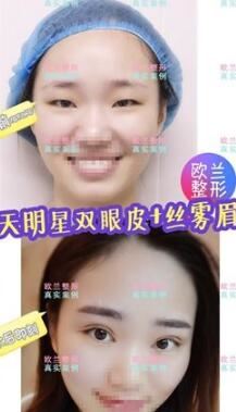 赵丽