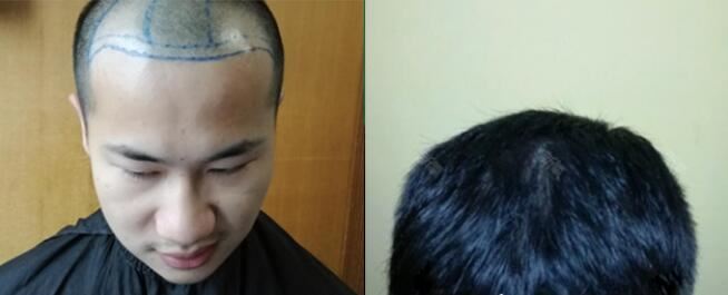 崔鹏程