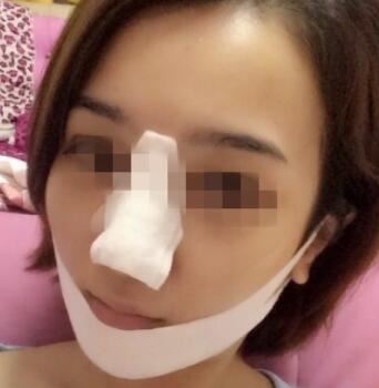 李雪梅