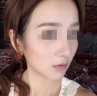 李雪梅