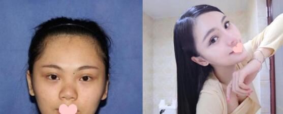 刘冰