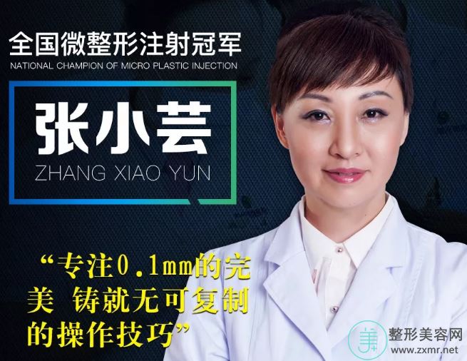 张小芸