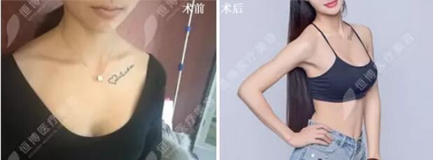 李烈