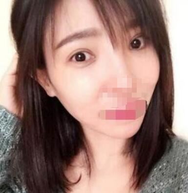 朴善优