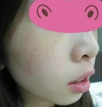 朴善优