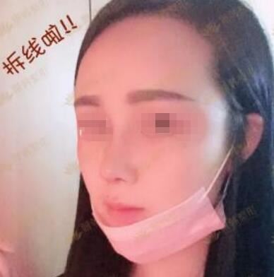 朴善优