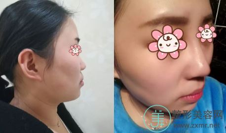 于晟