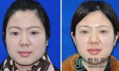 许晓妮
