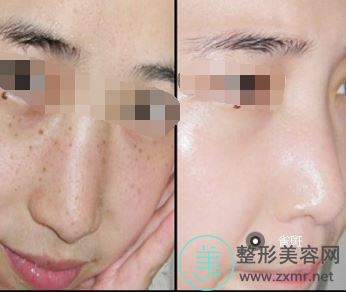 张莉
