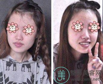 赵琳