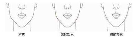 蒋亚楠