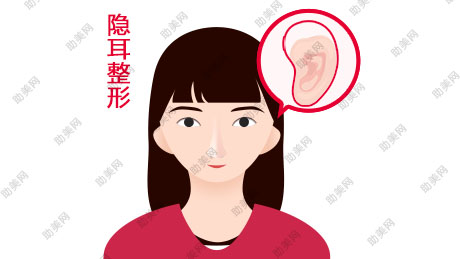 双侧隐耳矫正术可同时治疗不