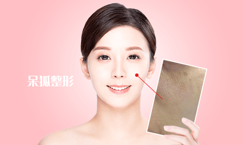 光子嫩肤