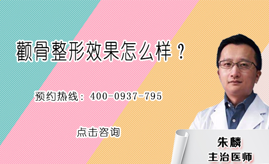 颧骨降低术