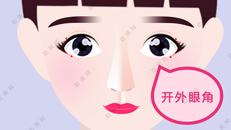 深圳和美开完内眼角后护理