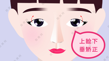 上睑松弛矫正手术效果怎样