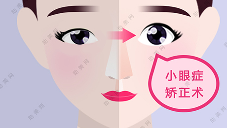 小眼症矫正的手术方法有几种？