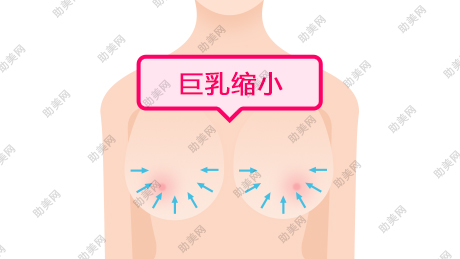 韩妃乳房缩小的理想标准是啥
