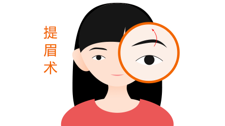 提眉手术适合哪些人来做呢