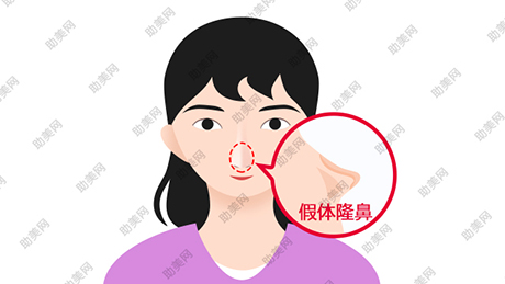 打透明质酸隆鼻的原理是什么