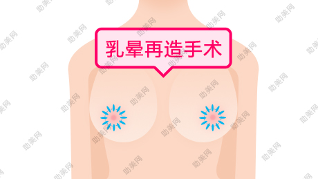 江汉王绍光乳晕发黑怎么办呢？