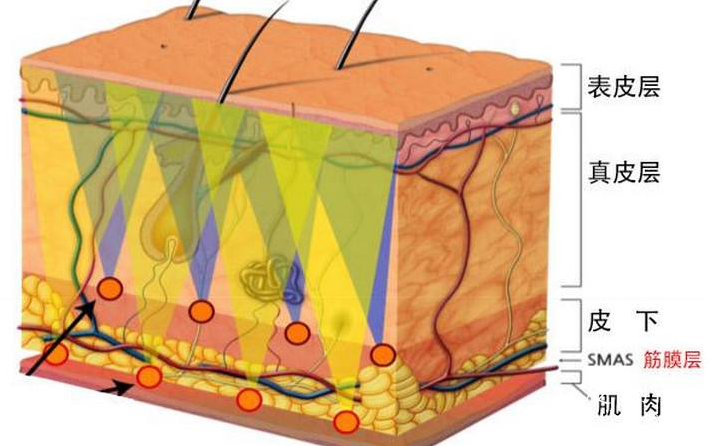 smas 筋膜层.png